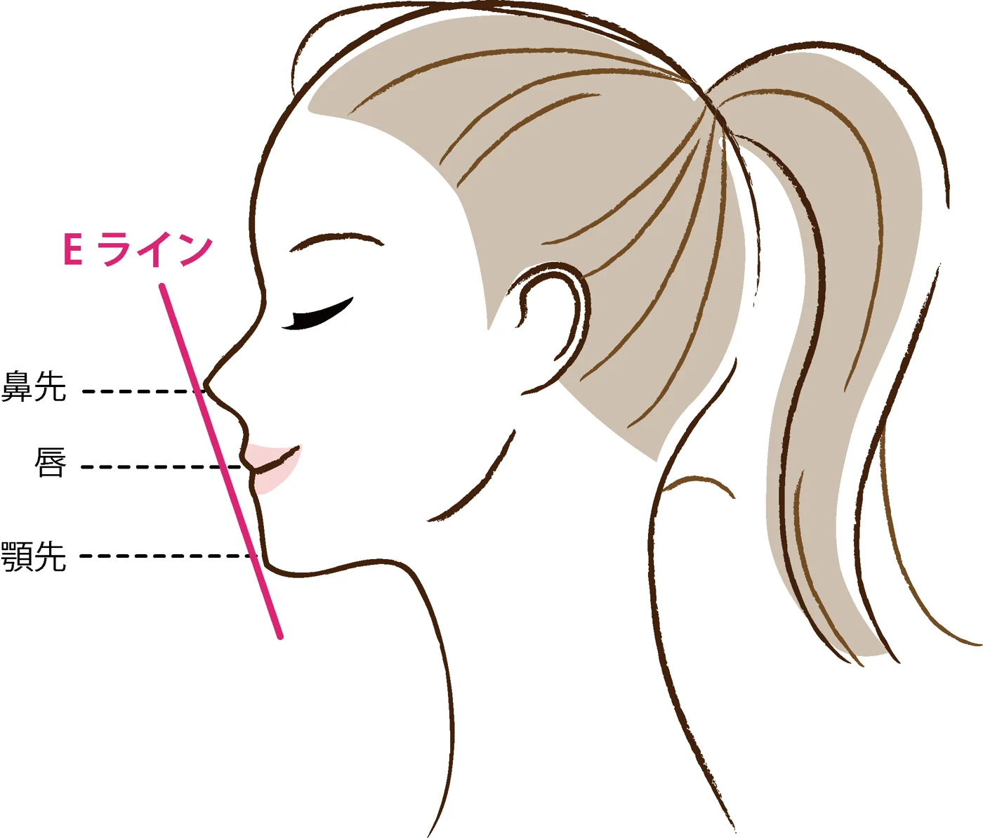口ゴボの矯正後に期待できる変化とは？改善プロセスと注意点を解説【静岡歯科が解説！】の参考画像